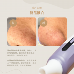 .Skin Roots Pores Cares Home Tool (Bye-Bye Blackheads) (C)